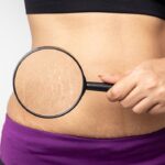 Jak zapobiegać tworzeniu się tłuszczu na twarzy?