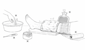 Person's foot soaking in a basin of water while a leg rests on a towel and a wrapped bandage-covered leg lies nearby, with a hot water bottle, cream jar, towel, and thermometer around as part of a home care setup.